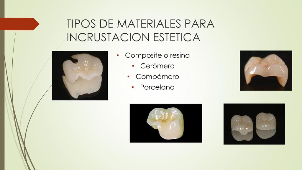 TIPOS DE MATERIALES PARA INCRUSTACION ESTETICA