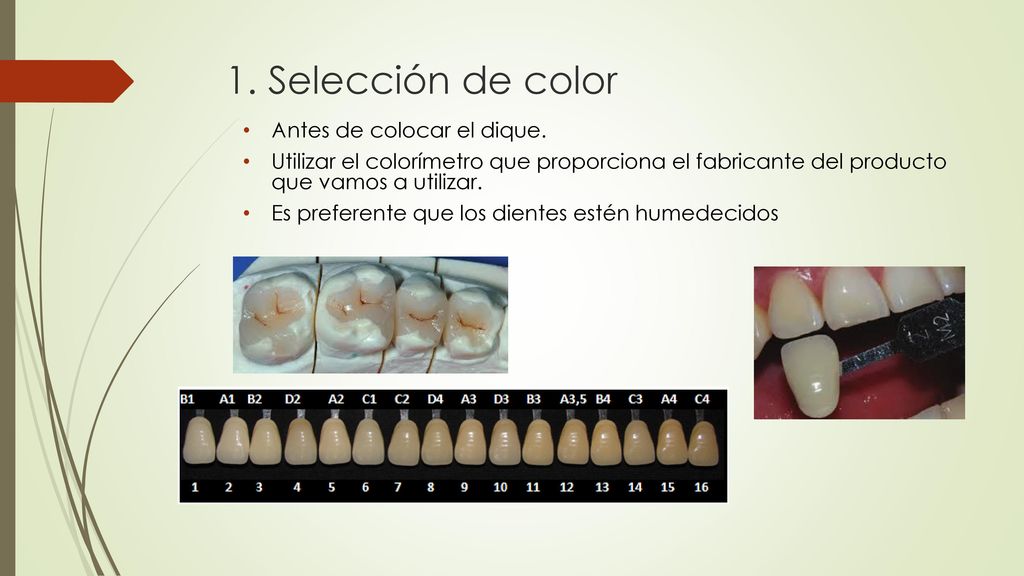 1. Selección de color Antes de colocar el dique.