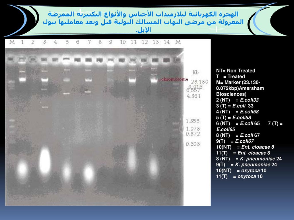 الهجرة الكهربائية لبلازميدات الأجناس والأنواع البكتيرية الممرضة المعزولة من مرضى التهاب المسالك البولية قبل وبعد معاملتها ببول الإبل.