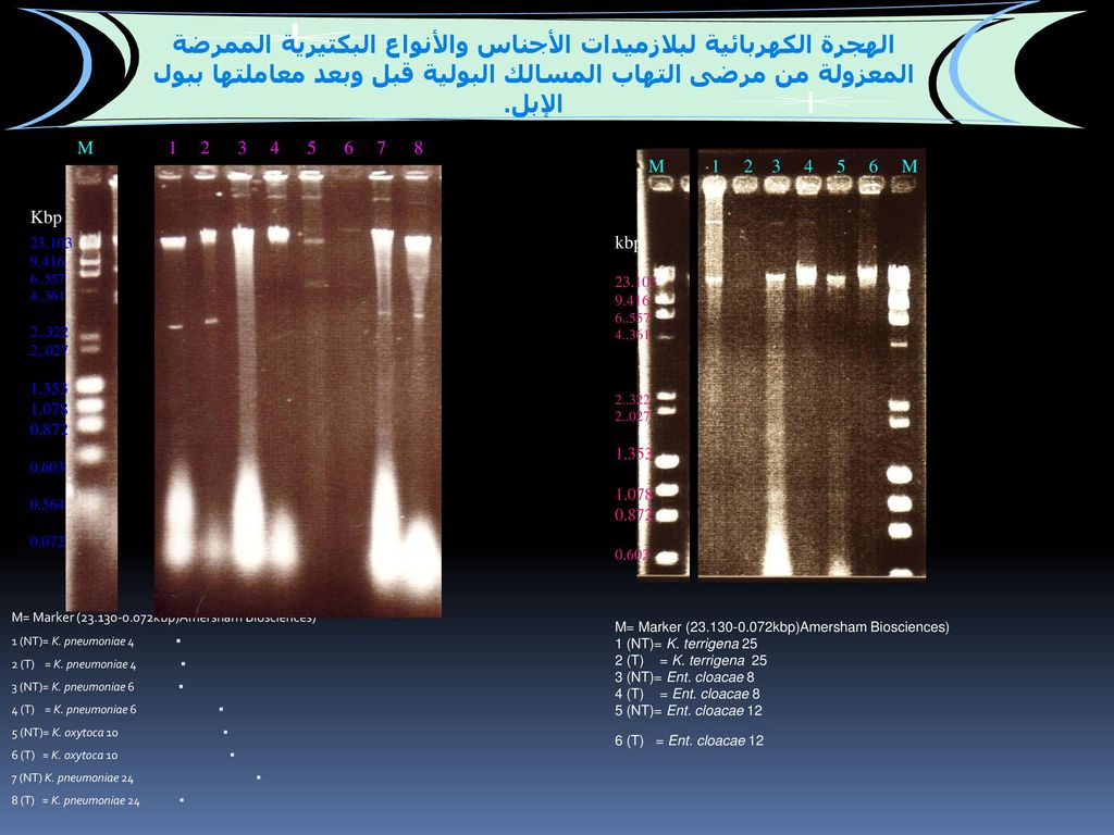 الهجرة الكهربائية لبلازميدات الأجناس والأنواع البكتيرية الممرضة المعزولة من مرضى التهاب المسالك البولية قبل وبعد معاملتها ببول الإبل.
