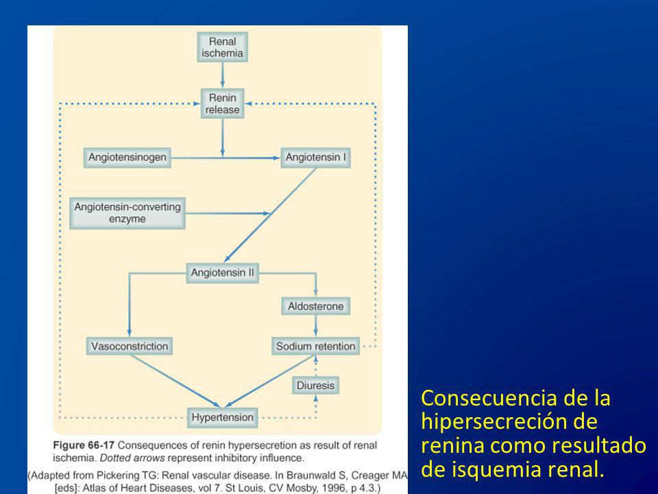 Consecuencia de la hipersecreción de renina como resultado de isquemia renal.