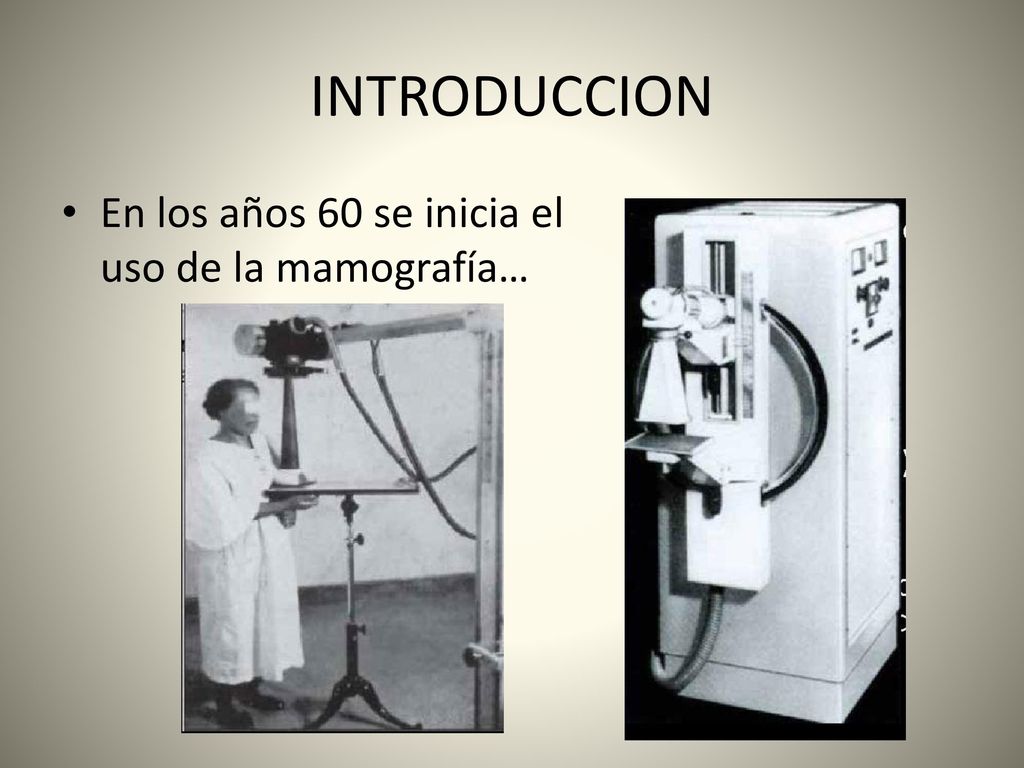 INTRODUCCION En los años 60 se inicia el uso de la mamografía…