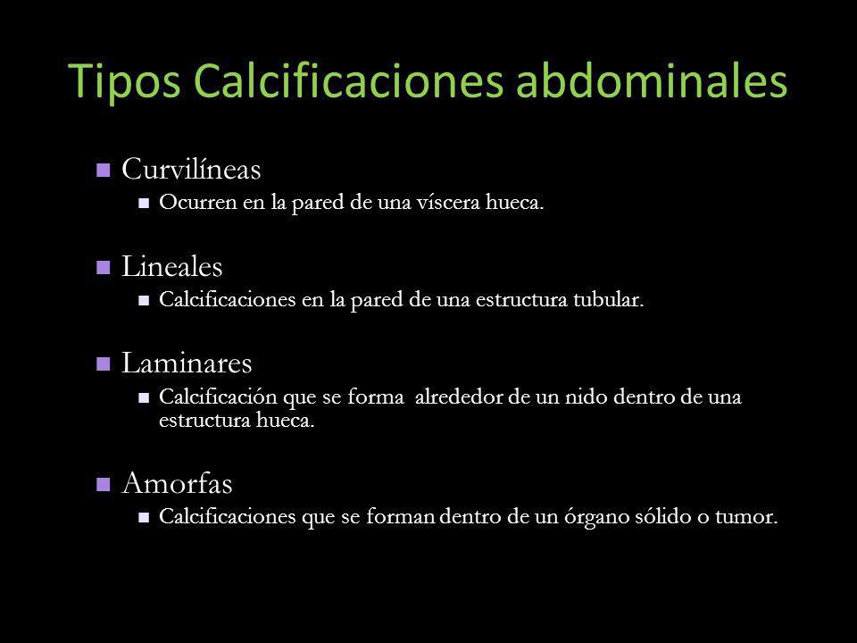 Tipos Calcificaciones abdominales