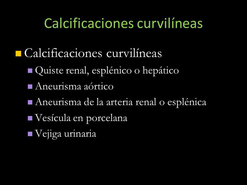 Calcificaciones curvilíneas