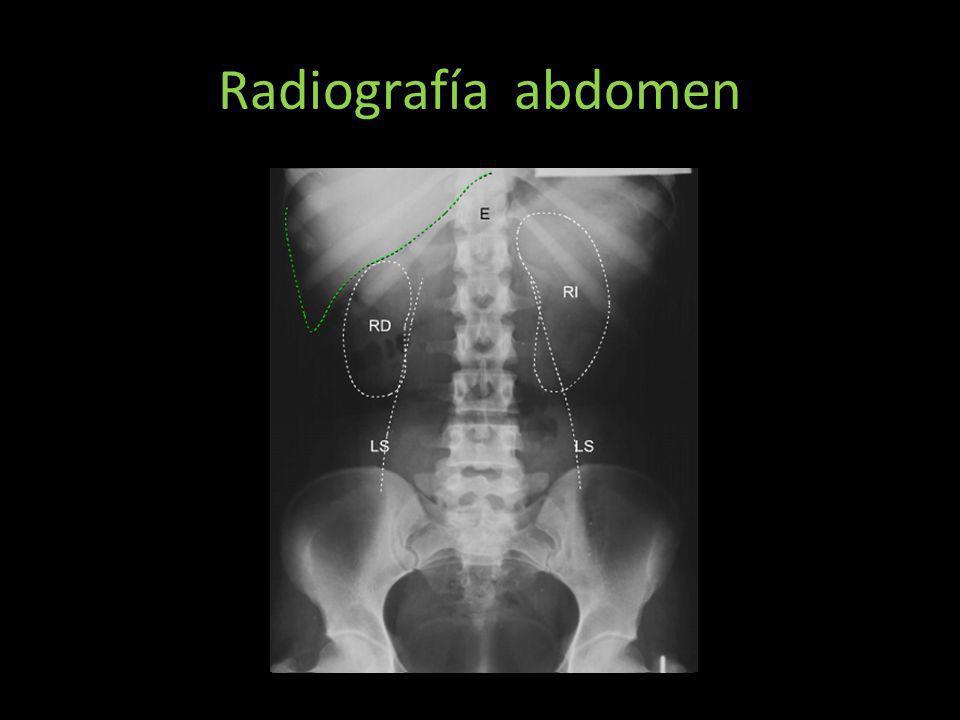 Radiografía abdomen Radiografia normal de abdomen de paciente joven por el patrón de calcificación ósea y ausencia de desgaste articular.