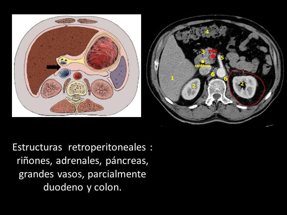 Corte en T9 que muestra (1) el lóbulo hepático derecho, (2) riñones, (3) páncreas y (4) colon transverso. Ya no se observa el bazo. La cabeza del páncreas se ubica lateral al (5) orígen de la AMS. La VMS se encuentra en el borde medial y anterior de la cabeza del páncreas, insuficientemente contrastada por encontrarse en fase arterial. En el borde postero-lateral de la cabeza del páncreas se encuentra el colédoco. Los riñones se encuentran rodeados de la facia de Gerota, más notoria en el riñón izquierdo, el cual está rodeado de una gran cantidad de tejido adiposo. La Aorta está rodeada por (6) los pilares diafragmáticos y de ella nace la arteria mesentérica superior.