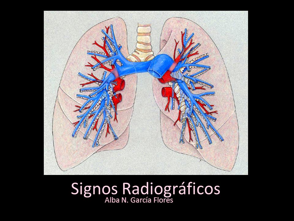 Signos Radiográficos Alba N. García Flores