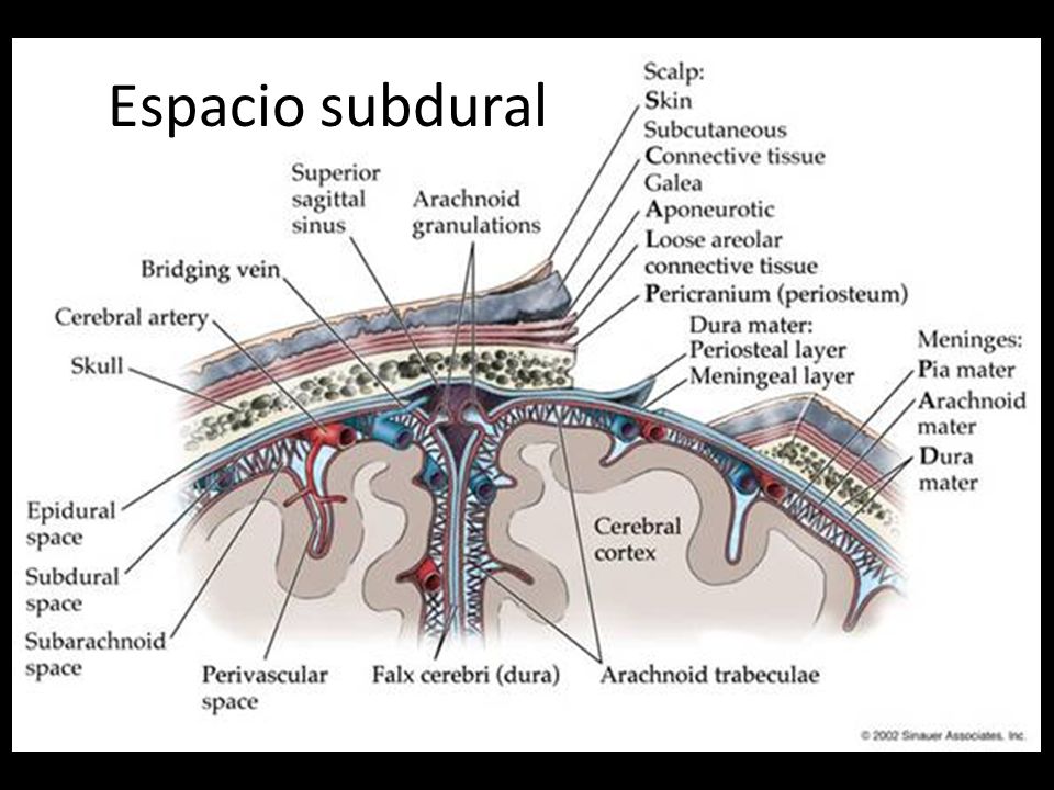 Espacio subdural Espacio comprendido entre la dura y la aracnoides