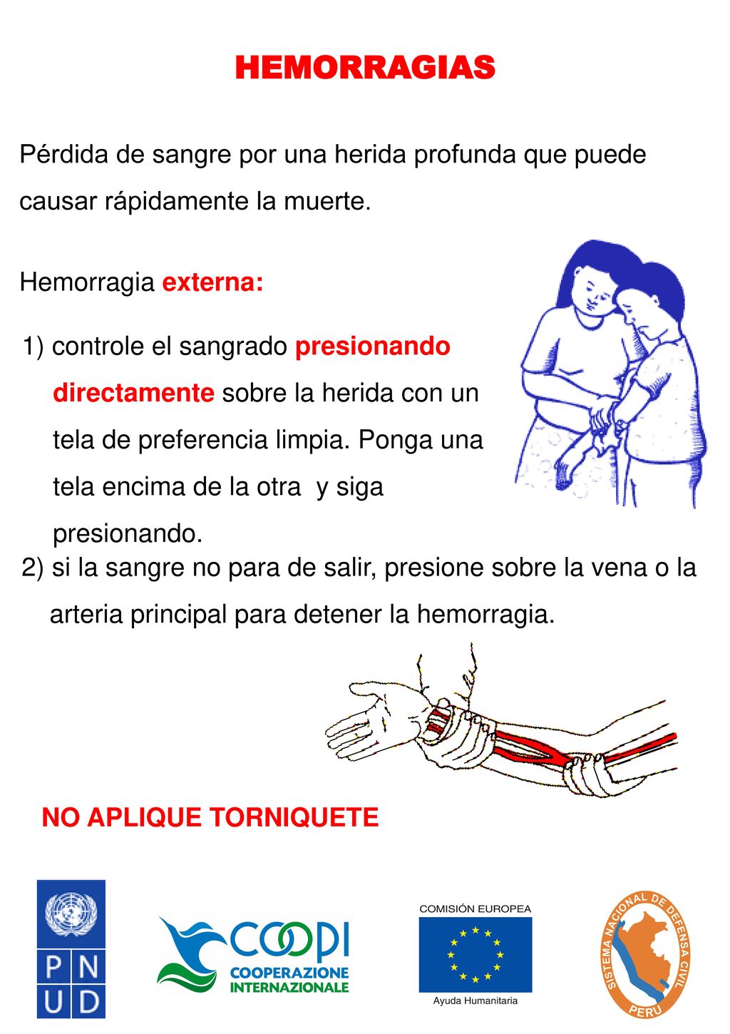 HEMORRAGIAS Pérdida de sangre por una herida profunda que puede causar rápidamente la muerte. Hemorragia externa: