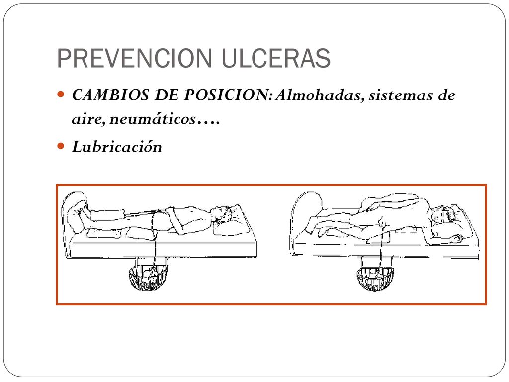 PREVENCION ULCERAS CAMBIOS DE POSICION: Almohadas, sistemas de aire, neumáticos…. Lubricación