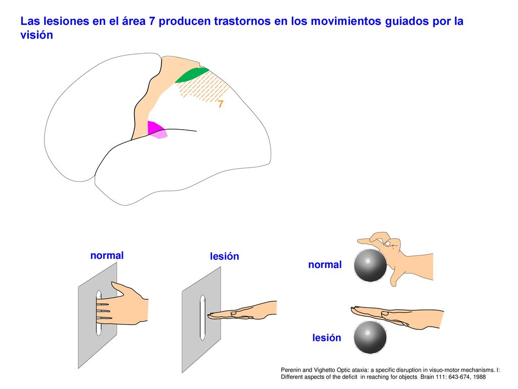 Las lesiones en el área 7 producen trastornos en los movimientos guiados por la visión