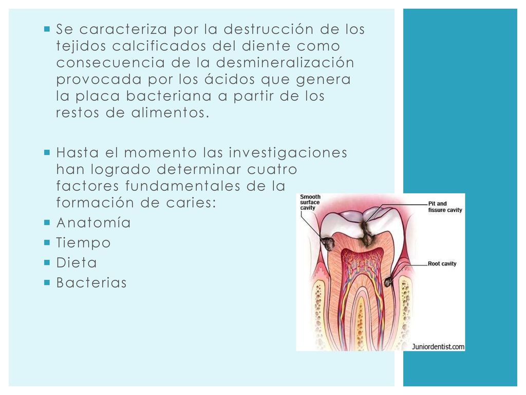 Se caracteriza por la destrucción de los tejidos calcificados del diente como consecuencia de la desmineralización provocada por los ácidos que genera la placa bacteriana a partir de los restos de alimentos.