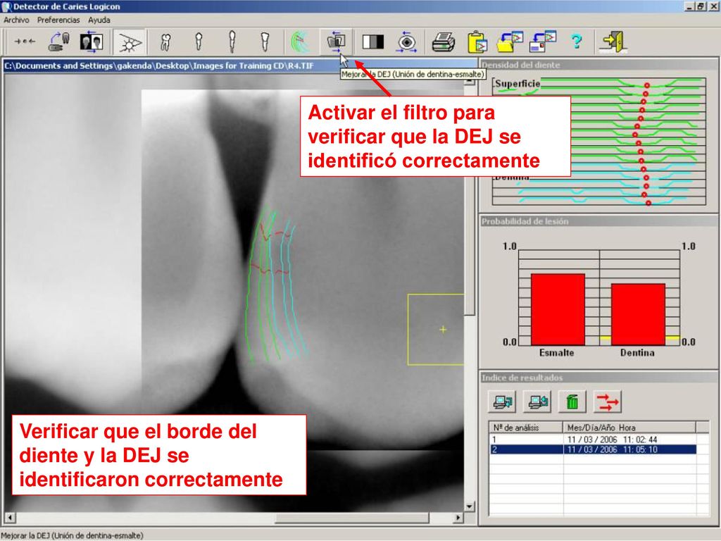 Activar el filtro para verificar que la DEJ se identificó correctamente
