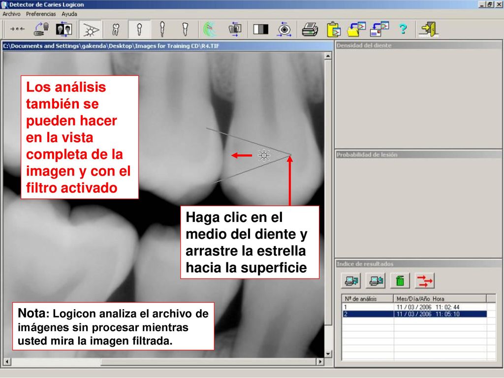 Los análisis también se pueden hacer en la vista completa de la imagen y con el filtro activado