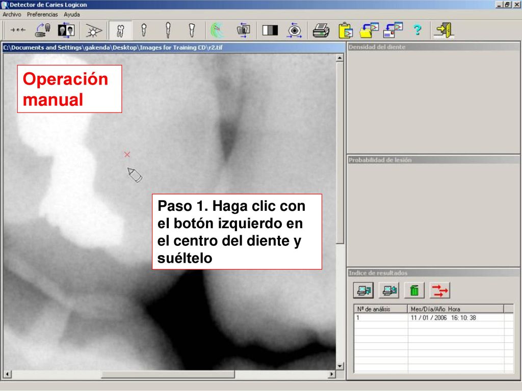 Operación manual Paso 1. Haga clic con el botón izquierdo en el centro del diente y suéltelo.