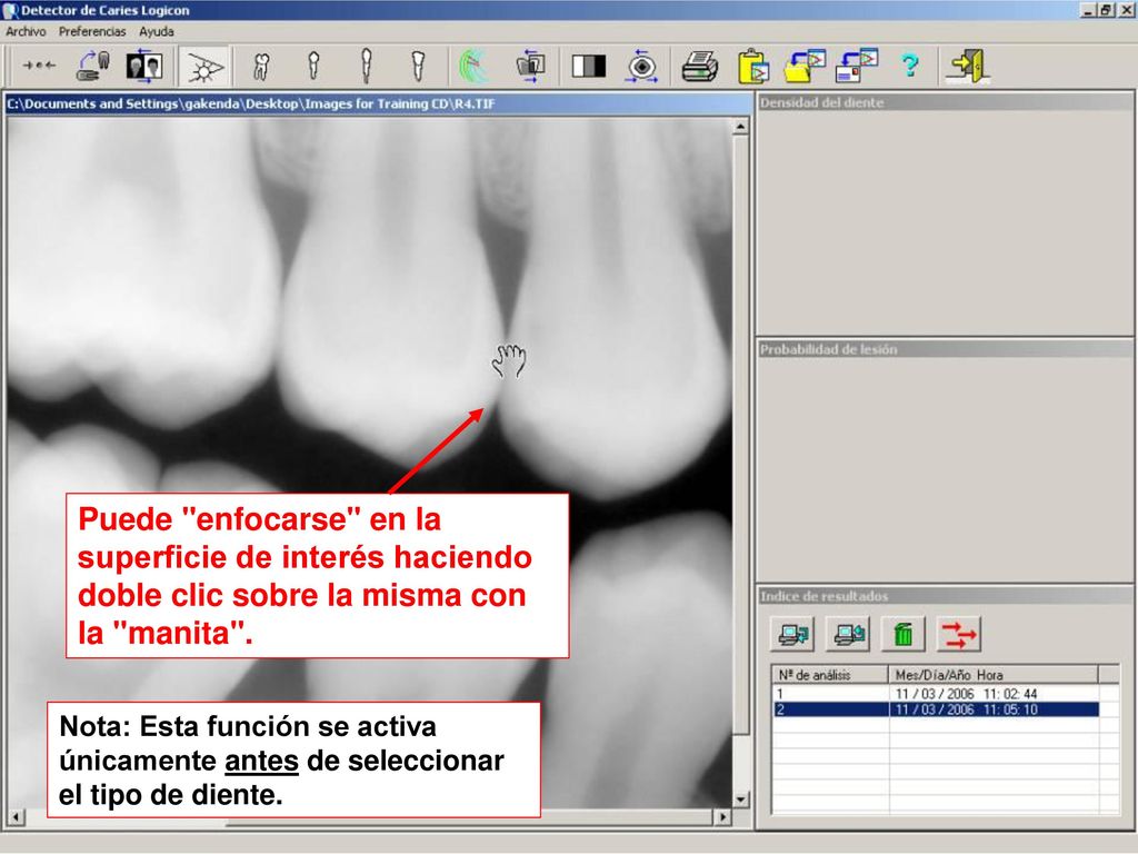 Puede enfocarse en la superficie de interés haciendo doble clic sobre la misma con la manita .