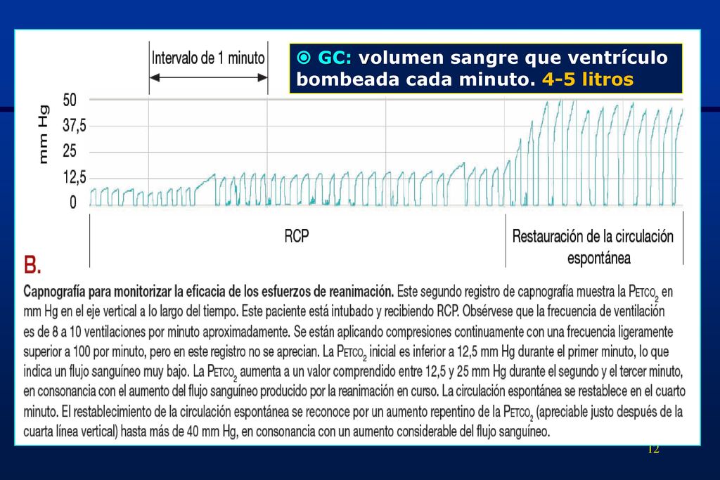  GC: volumen sangre que ventrículo bombeada cada minuto. 4-5 litros