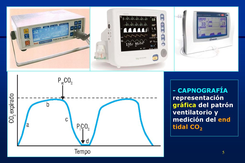 - CAPNOGRAFÍA representación gráfica del patrón ventilatorio y medición del end tidal CO2