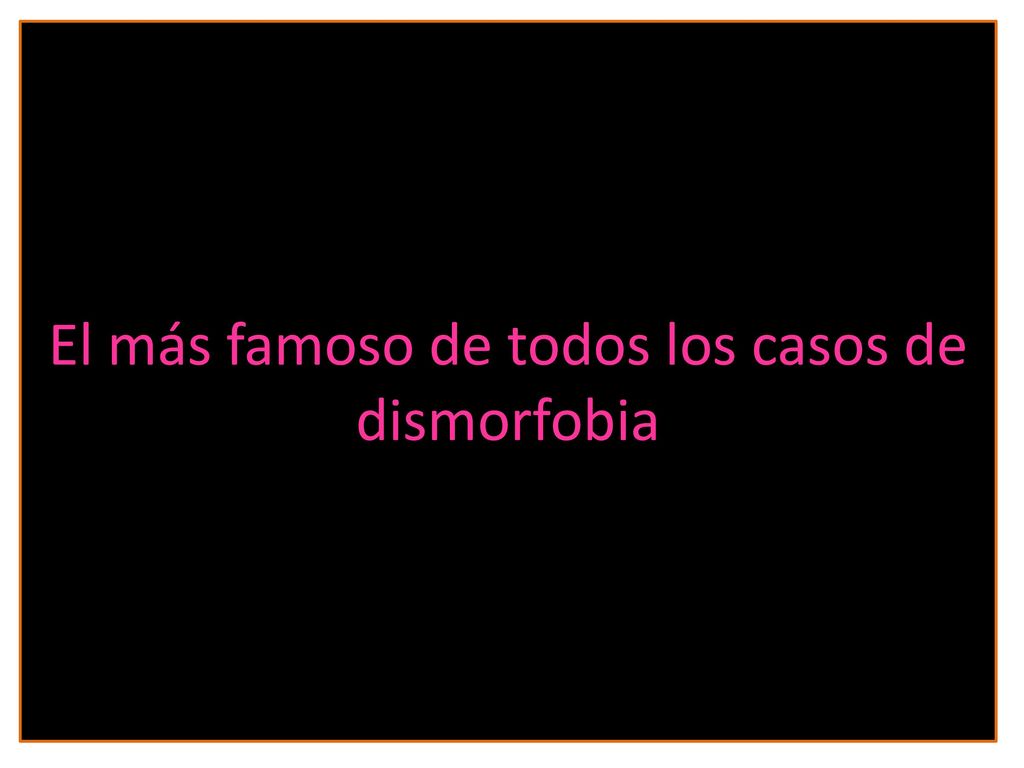 El más famoso de todos los casos de dismorfobia