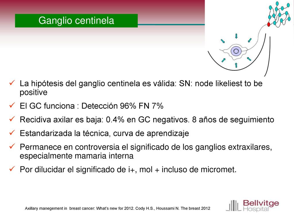 Ganglio centinela La hipótesis del ganglio centinela es válida: SN: node likeliest to be positive. El GC funciona : Detección 96% FN 7%