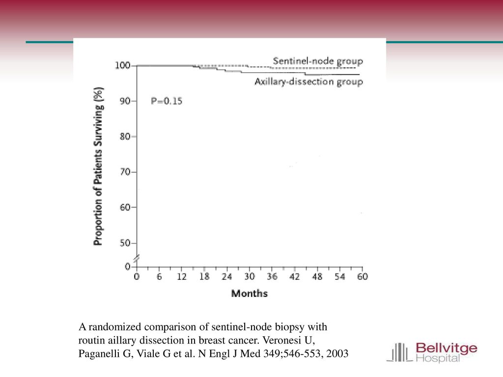 A randomized comparison of sentinel-node biopsy with routin aillary dissection in breast cancer.