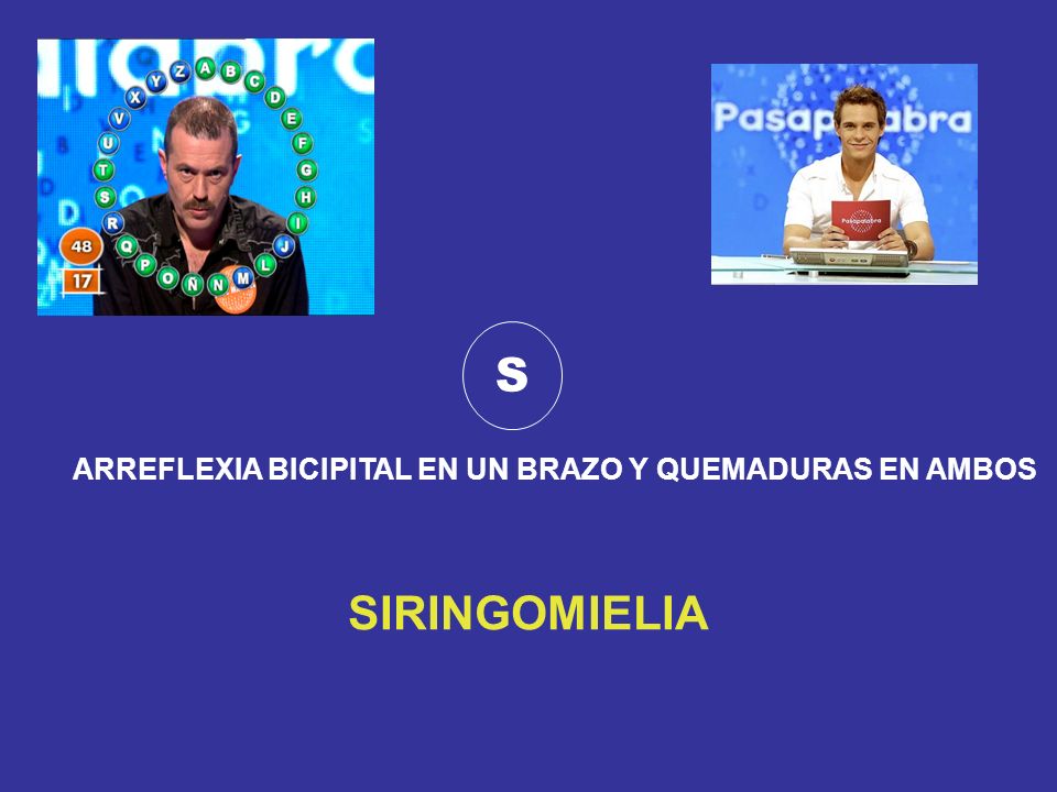 S ARREFLEXIA BICIPITAL EN UN BRAZO Y QUEMADURAS EN AMBOS SIRINGOMIELIA