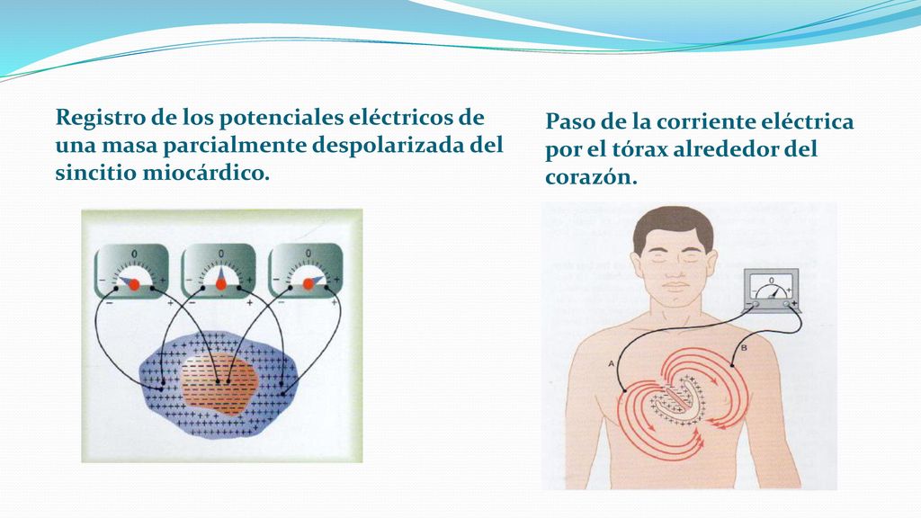 Registro de los potenciales eléctricos de una masa parcialmente despolarizada del sincitio miocárdico.