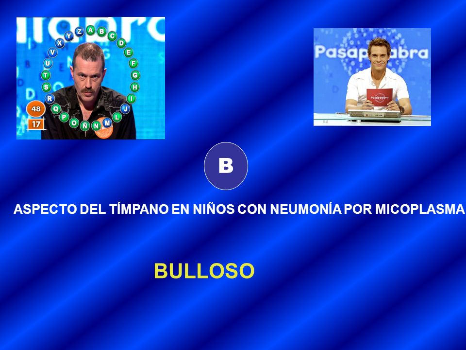 B ASPECTO DEL TÍMPANO EN NIÑOS CON NEUMONÍA POR MICOPLASMA BULLOSO