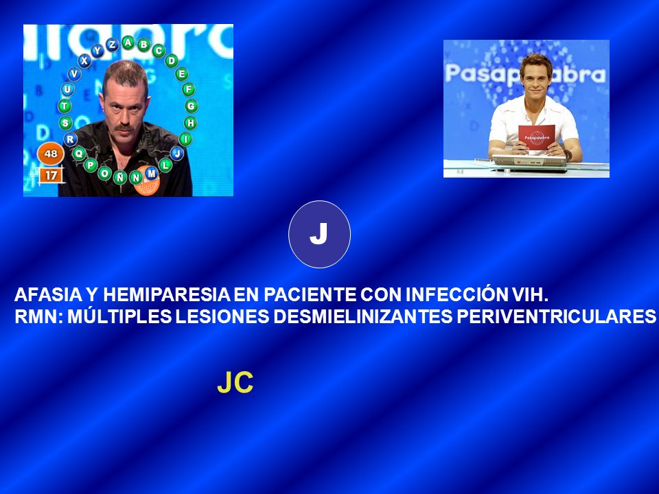J JC AFASIA Y HEMIPARESIA EN PACIENTE CON INFECCIÓN VIH.