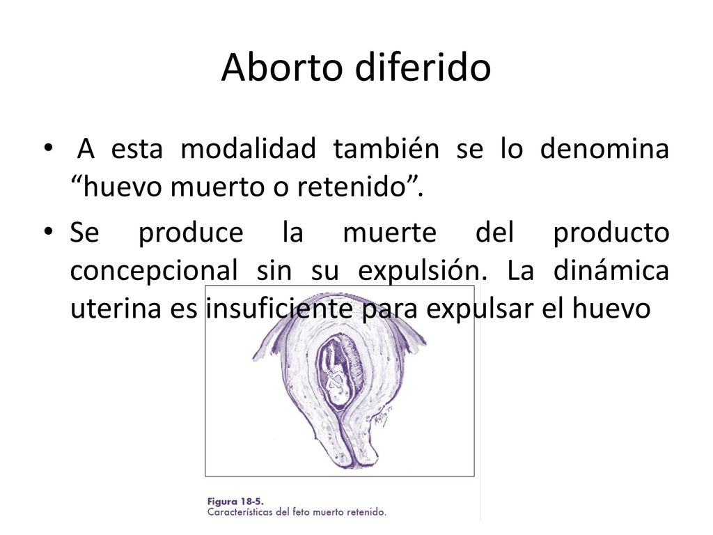Aborto diferido A esta modalidad también se lo denomina huevo muerto o retenido .