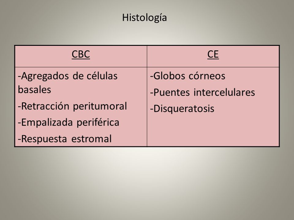 Histología CBC. CE. -Agregados de células basales. -Retracción peritumoral. -Empalizada periférica.