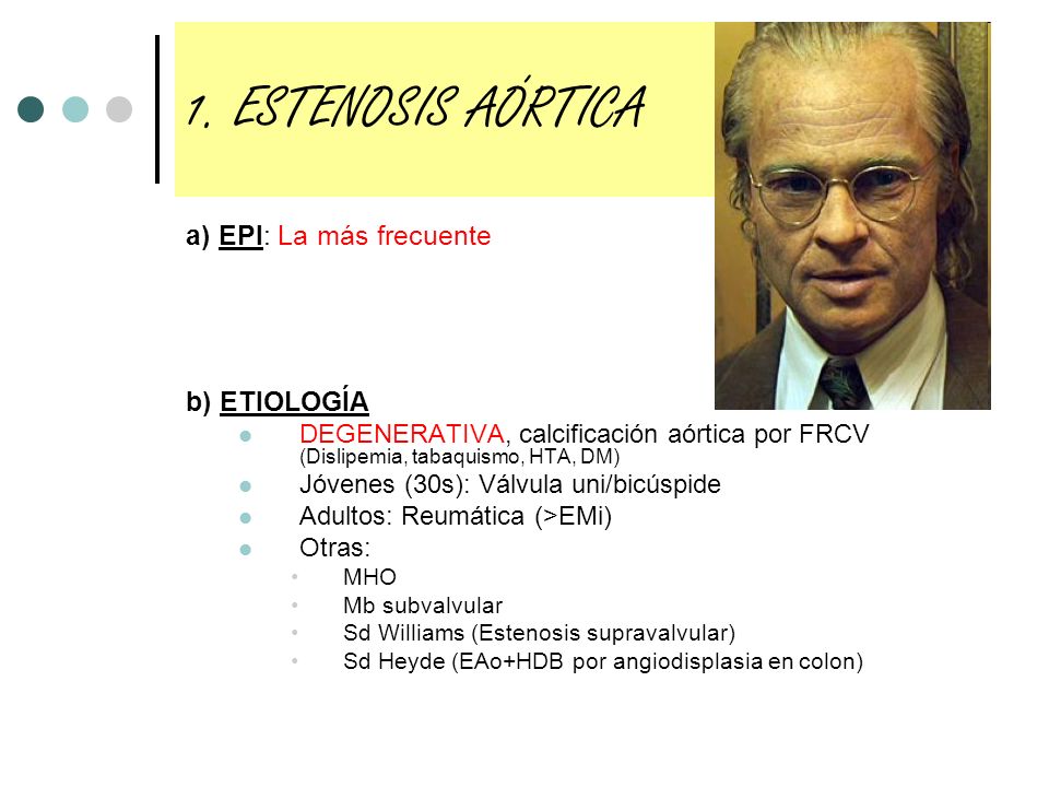 1. ESTENOSIS AÓRTICA a) EPI: La más frecuente b) ETIOLOGÍA