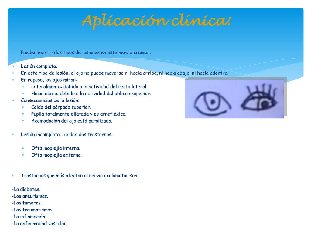 Aplicación clínica: Pueden existir dos tipos de lesiones en este nervio craneal: Lesión completa.