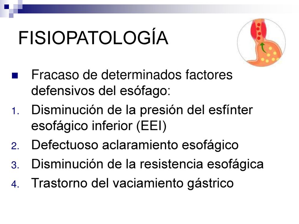FISIOPATOLOGÍA Fracaso de determinados factores defensivos del esófago: Disminución de la presión del esfínter esofágico inferior (EEI)