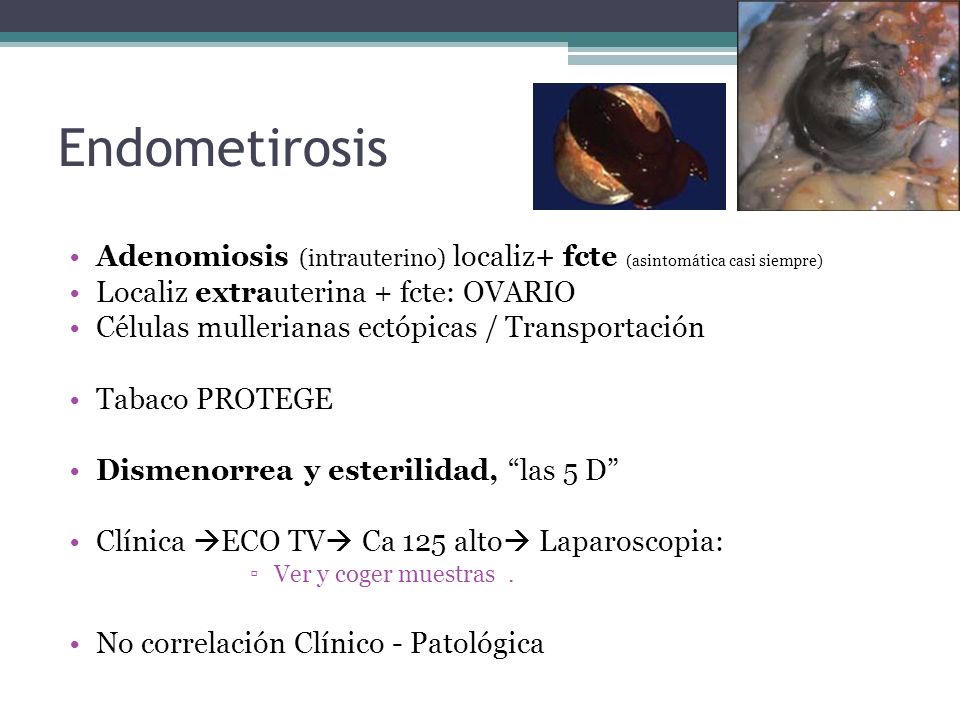Endometirosis Adenomiosis (intrauterino) localiz+ fcte (asintomática casi siempre) Localiz extrauterina + fcte: OVARIO.