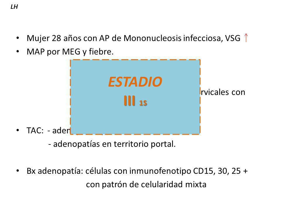 ESTADIO III 1S Mujer 28 años con AP de Mononucleosis infecciosa, VSG