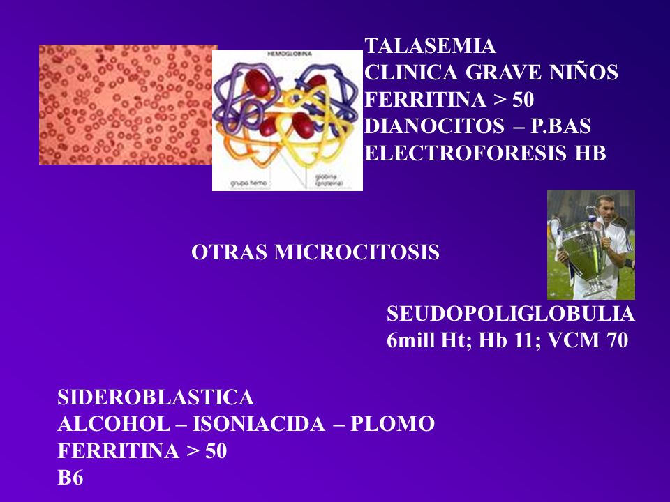 TALASEMIA CLINICA GRAVE NIÑOS. FERRITINA > 50. DIANOCITOS – P.BAS. ELECTROFORESIS HB. OTRAS MICROCITOSIS.