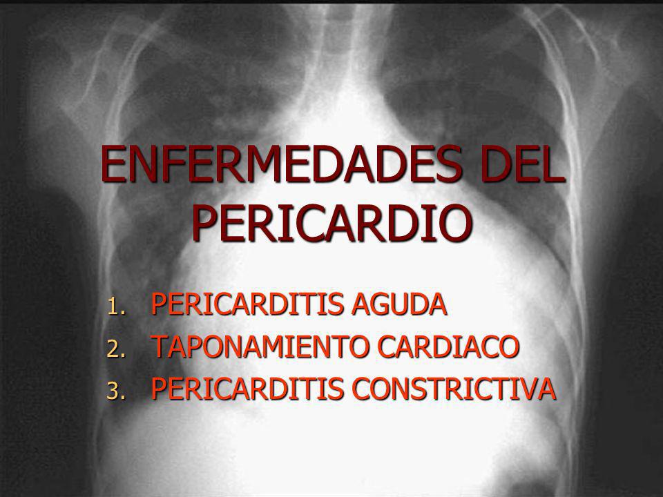 ENFERMEDADES DEL PERICARDIO