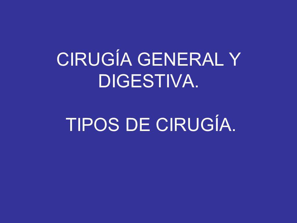 CIRUGÍA GENERAL Y DIGESTIVA. TIPOS DE CIRUGÍA.