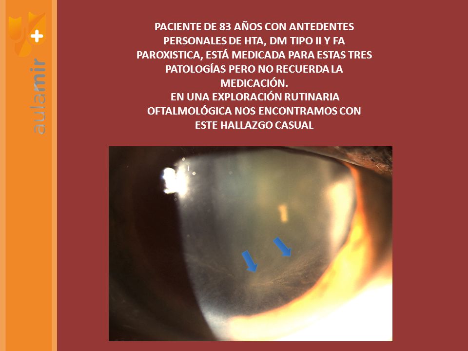 PACIENTE DE 83 AÑOS CON ANTEDENTES PERSONALES DE HTA, DM TIPO II Y FA PAROXISTICA, ESTÁ MEDICADA PARA ESTAS TRES PATOLOGÍAS PERO NO RECUERDA LA MEDICACIÓN.