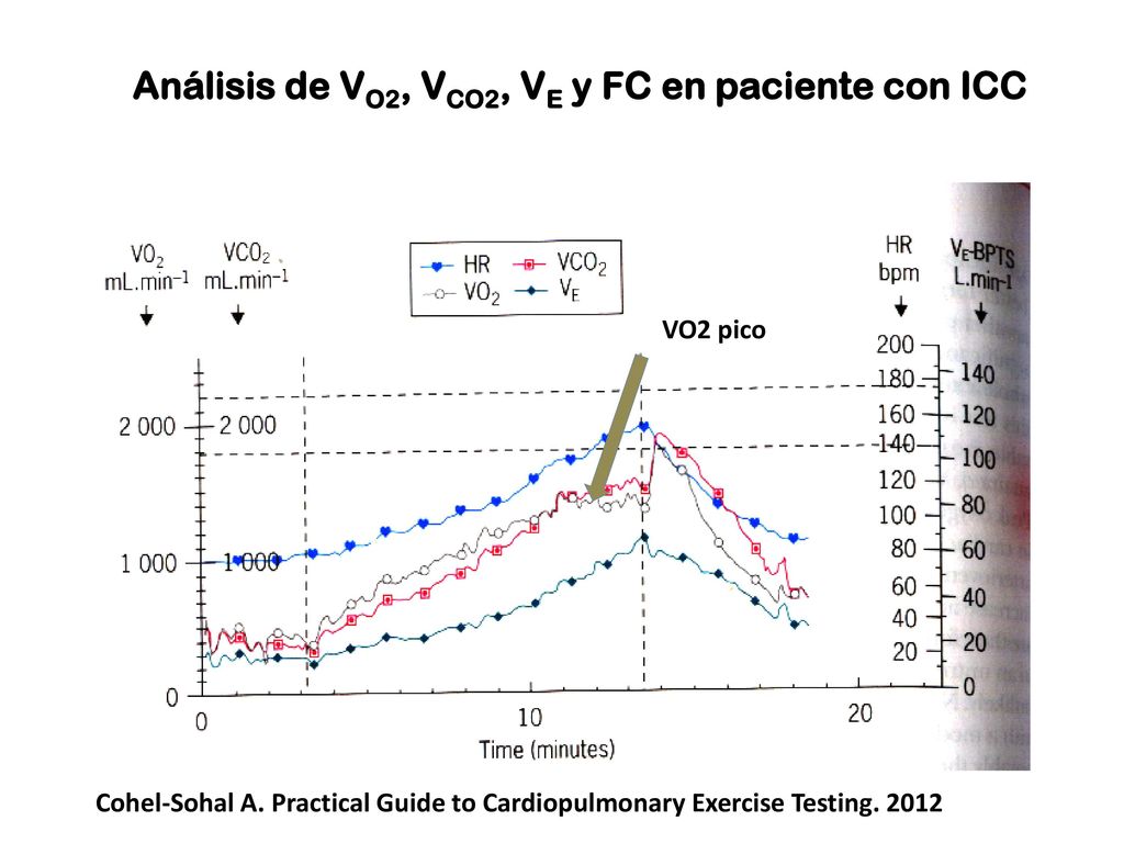 Análisis de VO2, VCO2, VE y FC en paciente con ICC