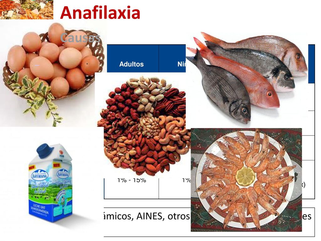 Anafilaxia 30 November Causas. Adultos. Niños. Series españolas. (Incluye población pediátrica)