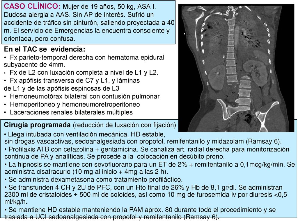 CASO CLÍNICO: Mujer de 19 años, 50 kg, ASA I. Dudosa alergia a AAS