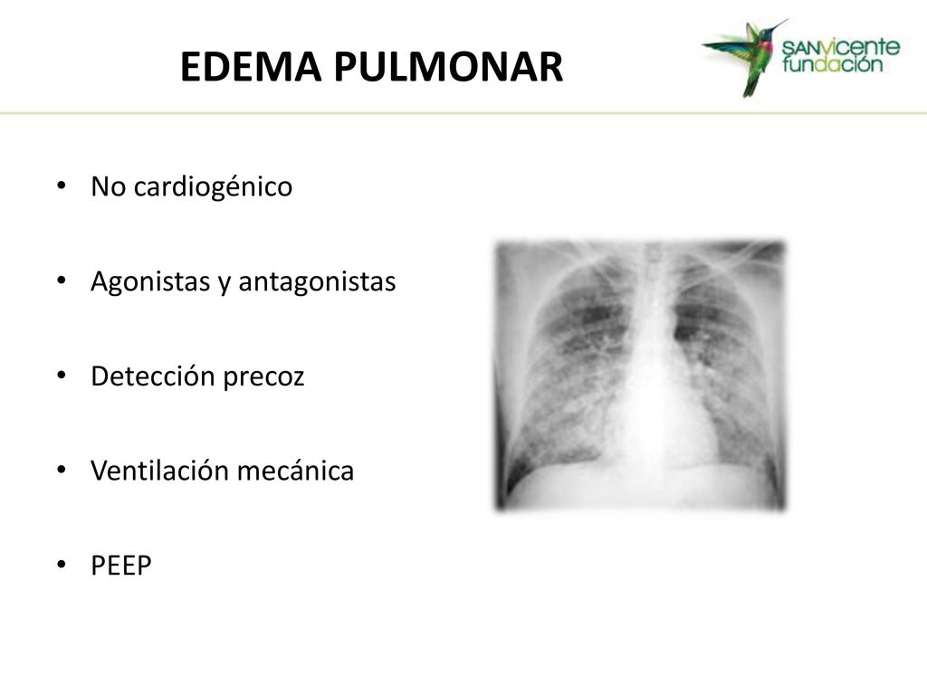 EDEMA PULMONAR No cardiogénico Agonistas y antagonistas