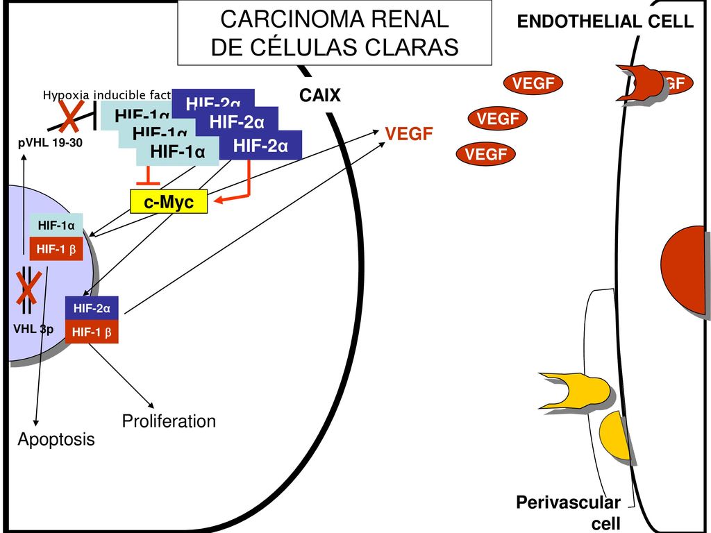CARCINOMA RENAL DE CÉLULAS CLARAS ENDOTHELIAL CELL CAIX HIF-2α HIF-α