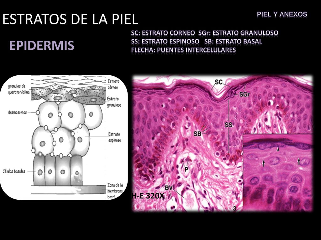 ESTRATOS DE LA PIEL EPIDERMIS H-E 320X PIEL y anexos