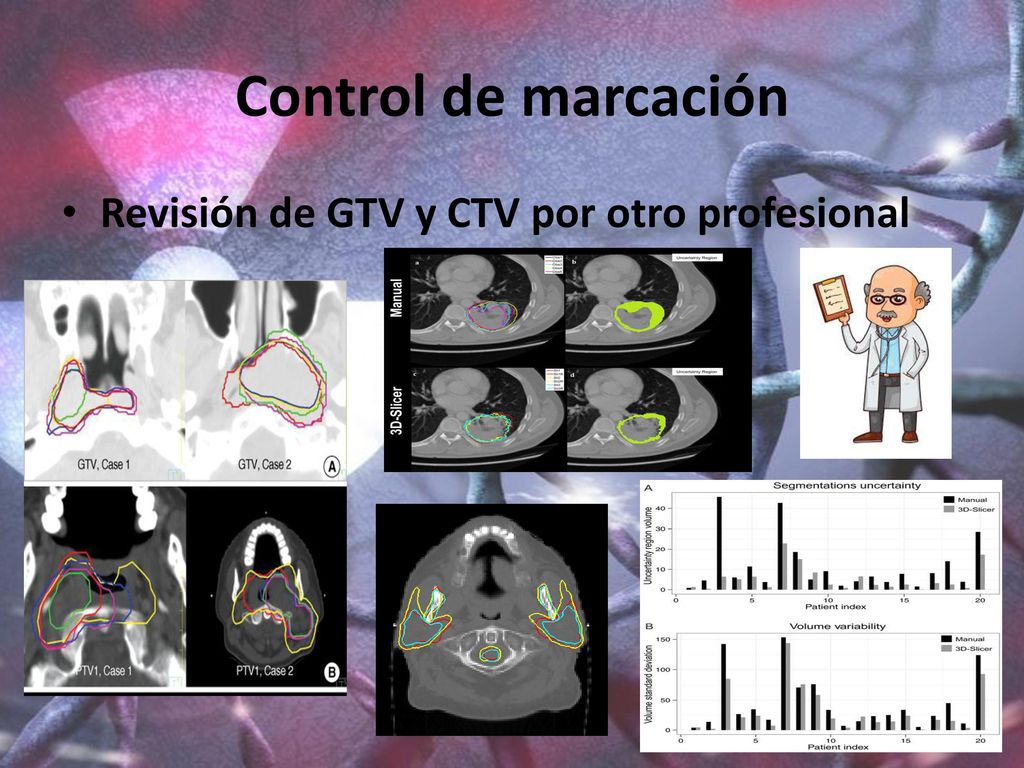 Control de marcación Revisión de GTV y CTV por otro profesional