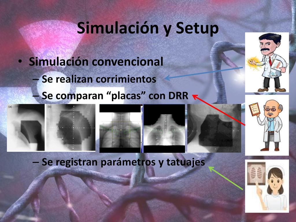 Simulación y Setup Simulación convencional Se realizan corrimientos