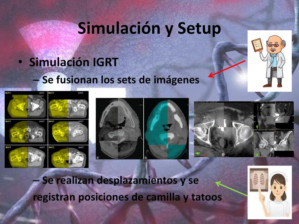 Simulación y Setup Simulación IGRT Se fusionan los sets de imágenes