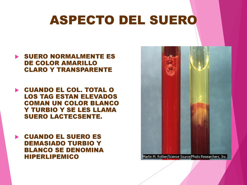 ASPECTO DEL SUERO SUERO NORMALMENTE ES DE COLOR AMARILLO CLARO Y TRANSPARENTE.